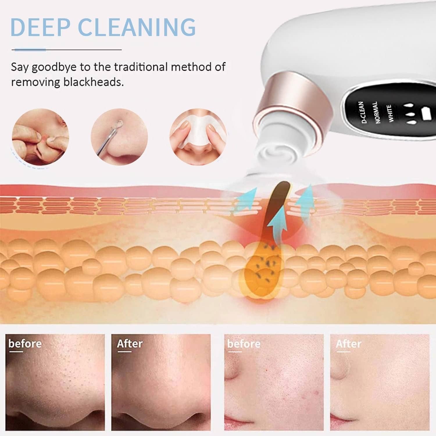 Electric Deep Cleansing Machine |  Blackhead Remover